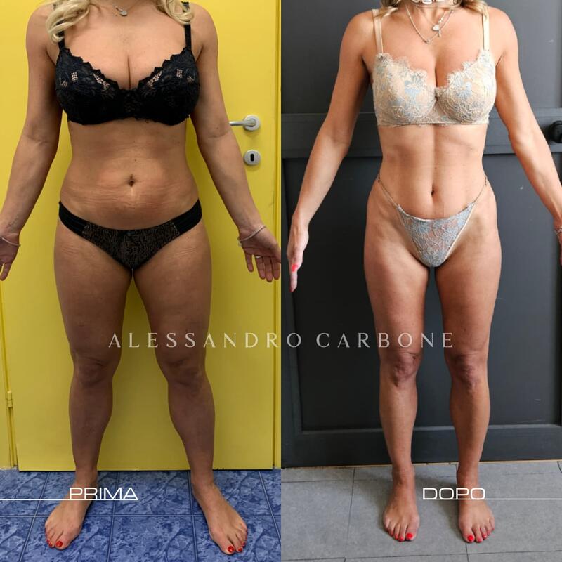 Testimonianza 4 - Prima e Dopo