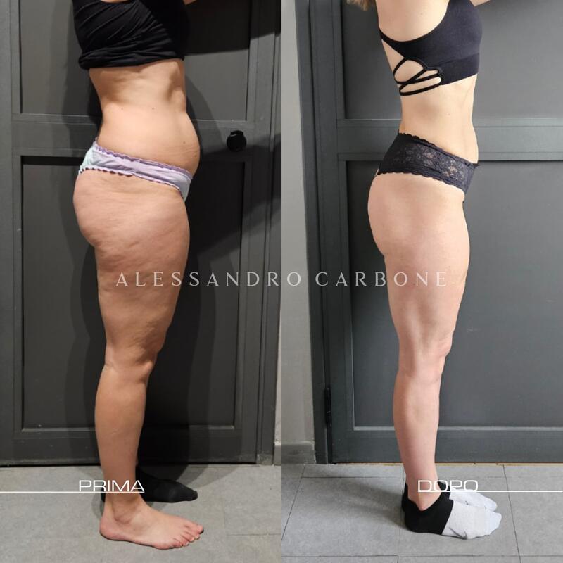 Testimonianza 1 - Foto 2