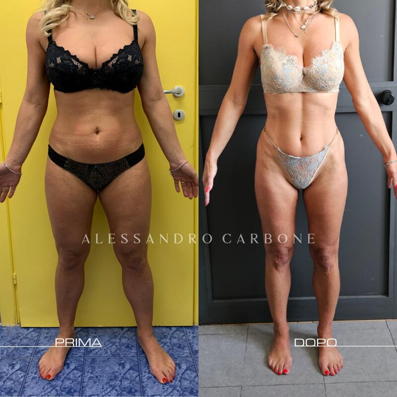 Testimonianza 16 - Foto 1