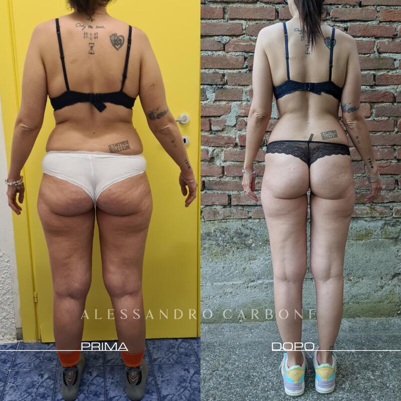 Testimonianza 2 - Foto 1