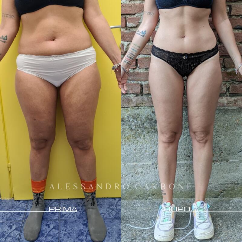 Testimonianza 2 - Foto 3