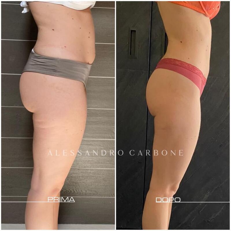 Testimonianza 23 - Foto 4