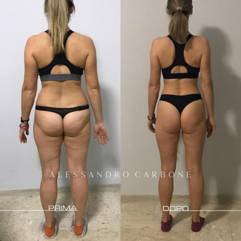 Testimonianza 3 - Foto 2