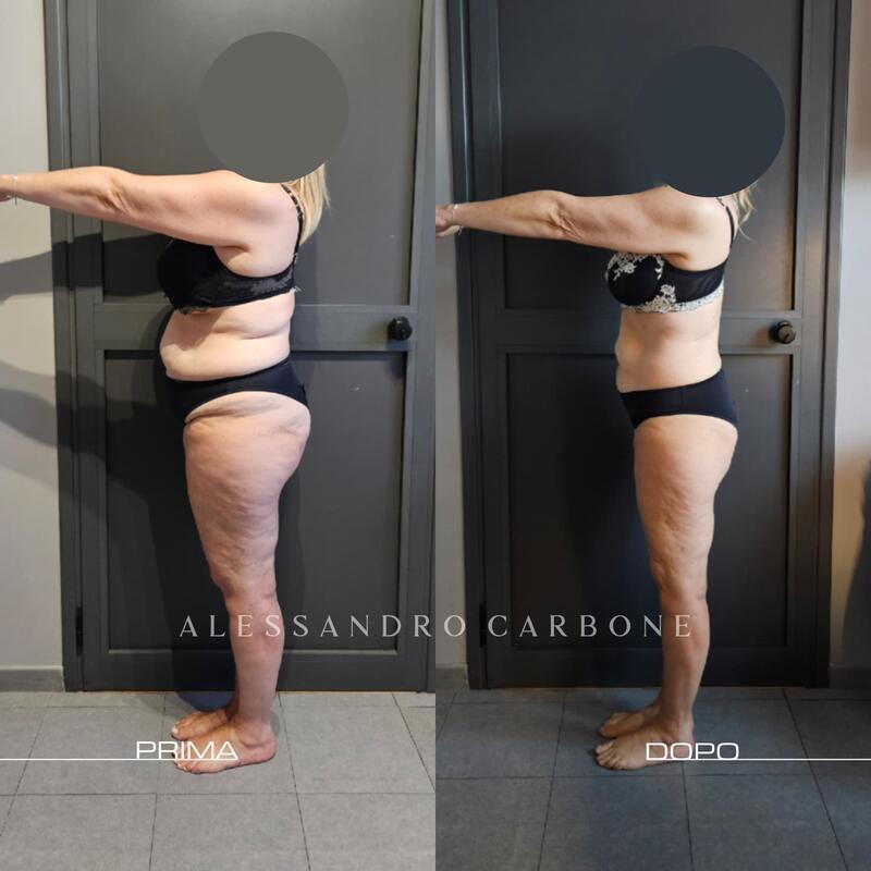 Testimonianza 35 - Foto 4