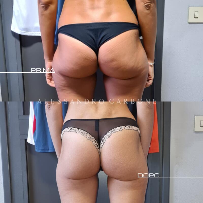 Testimonianza 36 - Foto 2