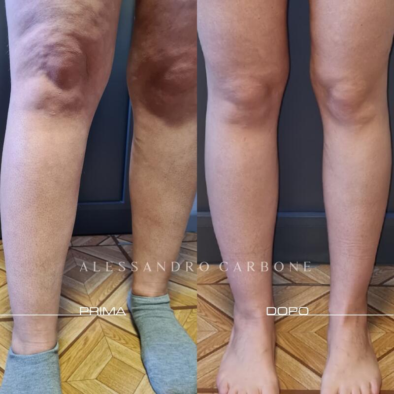 Testimonianza 37 - Foto 2