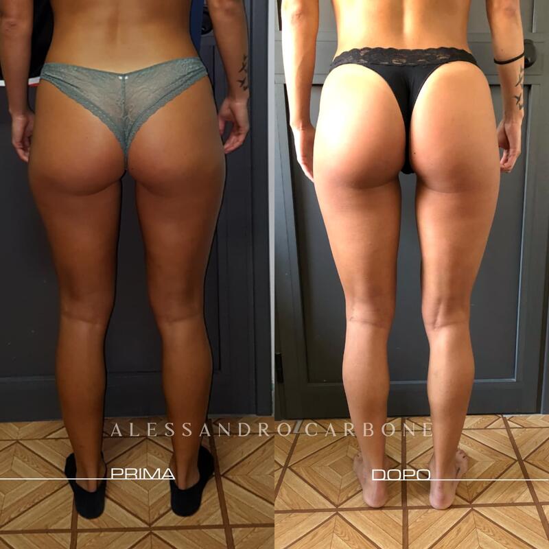 Testimonianza 4 - Foto 2