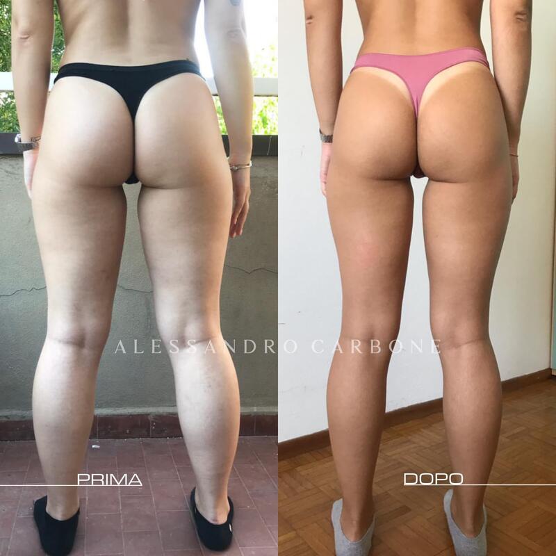 Testimonianza 42 - Foto 1