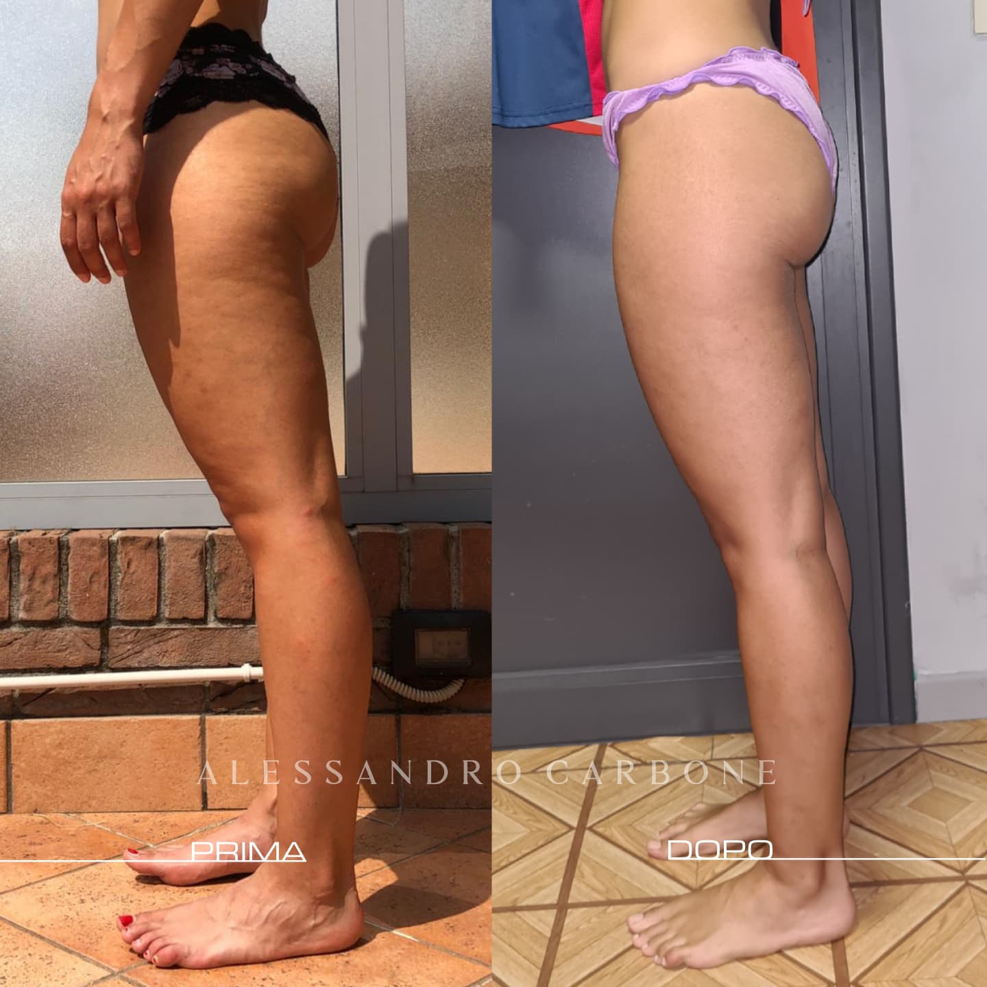 Testimonianza 44 - Foto 1